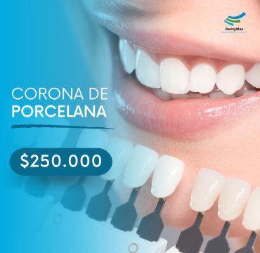 corona de porcelana